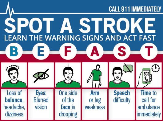 stroke in young adult